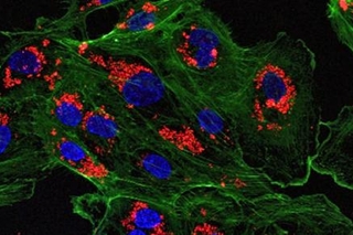 A microscopic image of endothelial cells treated with drug-loaded nanoparticles. (Image courtesy of the Saltzman Lab)