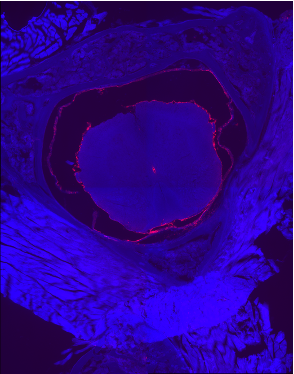 tissue engineering